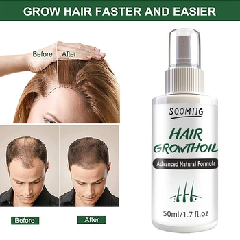 Saç Dökülmesini Etkili bir şekilde iyileştirin, Saç beslenmesini ve sağlığını İyileştirin-Bitki Saç Büyüme Özü